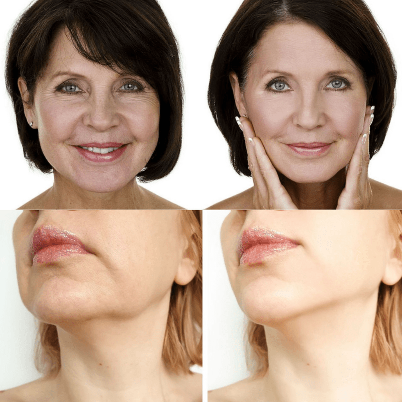 Face Glow 2.0® - Definição e Rejuvenescimento + Brinde - Imagem 3